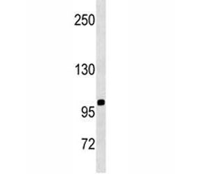 CD43 antibody western blot analysis in SK-BR-3 lysate. Predicted molecular weight 45-115 kDa depending on glycosylation level.