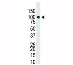 Western blot analysis of Dnmt3a antibody in T47-D cell lysate. Predicted molecular weight: 100-130 kDa
