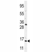 Western blot analysis of anti-Histone H3 in CEM lysate