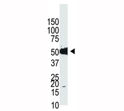 Western blot analysis of Dnmt2 antibody and HL-60 cell lysate