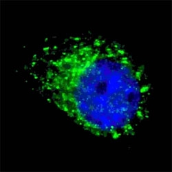 Fluorescent image of chloroquine treated U251 cells stained with MAP1LC3A antibody (1:100). Immunoreactivity is localized to autophagic vacuoles in the cytoplasm.