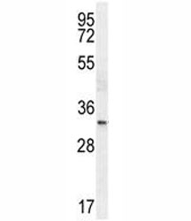 TTF-1 antibody western blot analysis in HeLa lysate.