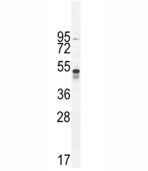 TNFR1 antibody western blot analysis in A549 lysate. Predicted molecular weight ~51kDa.
