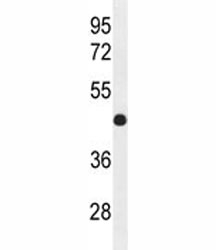 IRF2 antibody western blot analysis in mouse bladder tissue lysate. Estimated molecular weight: ~39kDa but routinely observed at 39-50kDa.