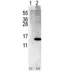 Western blot analysis of ISG15 antibody and 293 cell lysate (2 ug/lane) either nontransfected (Lane 1) or transiently transfected with ISG15 gene (2). Expected molecular weight: 15-17 kDa.