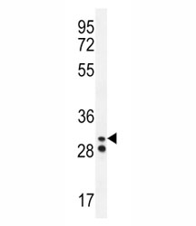 Neutrophil elastase antibody western blot analysis in A2058 lysate. Predicted molecular weight: 29-35 kDa.