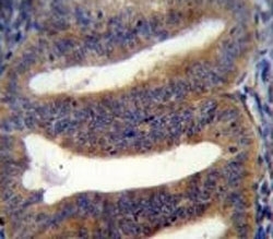 RBPMS2 antibody immunohsitochemistry analysis in formalin fixed and paraffin embedded human uterus tissue.