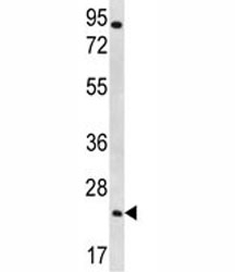 AQP5 antibody western blot analysis in NCI-H292 lysate. Predicted molecular weight ~28 kDa.