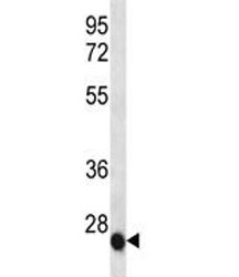 IL-6 antibody western blot analysis in NCI-H460 lysate
