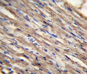 ACSM6 antibody analysis in formalin fixed and paraffin embedded human heart tissue.