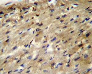 ABCD2 antibody immunohistochemistry analysis in formalin fixed and paraffin embedded human heart tissue.
