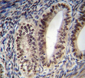 Progesterone Receptor antibody immunohistochemistry analysis in formalin fixed and paraffin embedded human uterus tissue.