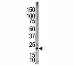 Western blot testing of Bim antibody and HL-60 cell lysate. Predicted molecular weight: 12-22 kDa (three isoforms).