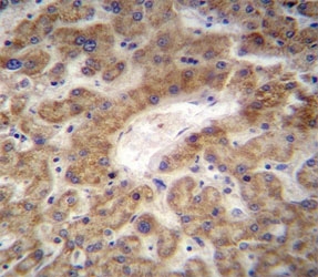 CXCL12 antibody immunohistochemistry analysis in formalin fixed and paraffin embedded human liver tissue.
