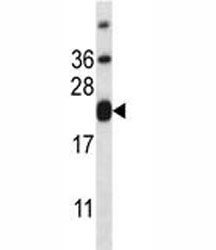 CD3e antibody western blot analysis in HL-60 lysate. Expected/observed molecular weight ~23kDa.