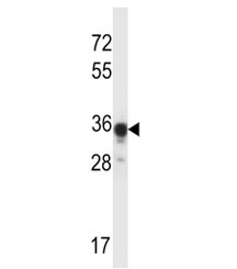 ABHD4 antibody western blot analysis in mouse kidney tissue lysate. Predicted molecular weight ~39 kDa.