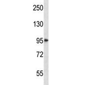 HDAC4 antibody western blot analysis in NCI-H292 lysate. Expected molecular weight: ~140 kDa (full length), ~95 kDa (truncated).