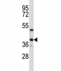 ERCC1 antibody western blot analysis in T47D lysate. Predicted molecular weight ~36kDa.