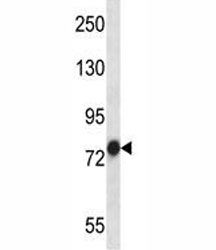 TRAP-1 antibody western blot analysis in NCI-H460 lysate. Expected molecular weight: 75-80 kDa.