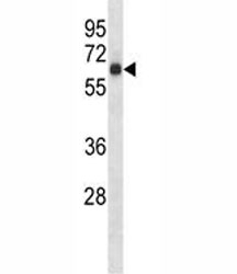 S6k1 antibody western blot analysis in mouse heart tissue lysate. Predicted molecular weight: 60-70 kDa