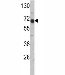 Western blot analysis of AFP antibody and HepG2 lysate. Predicted molecular weight: ~70kDa.