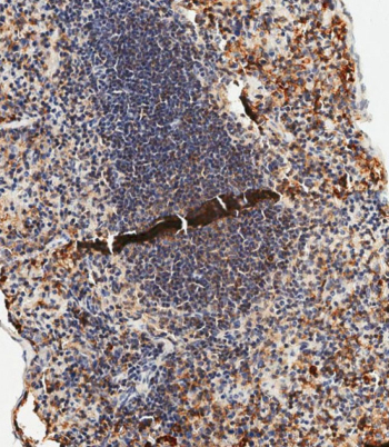 IHC staining of FFPE mouse spleen tissue with anti-TLR2 antibody. HIER: steam section in pH9 EDTA buffer for 20 min and allow to cool prior to staining.