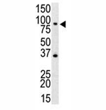 Western blot analysis of anti-TLR4 antibody and mouse spleen cell lysate