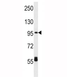CPT1C antibody western blot analysis in HL-60 lysate. Predicted molecular weight 81-91 kDa.