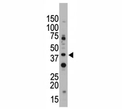 CD33 antibody used in western blot to detect CD33 in Jurkat cell lysate. Predicted molecular weight is 40-67 kDa depending on glycosylation level