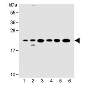 Western blot testing of 1) human HeLa, 2) human 293/T17, 3) mouse C2C12, 4) rat C6, 5) human HT-29 and 6) rat PC-12 cell lysate with KRAS antibody at 1:500. Expected molecular weight: 20-25 kDa.
