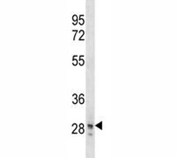 SNAI3 antibody western blot analysis in T47D lysate.