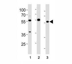HDAC antibody western blot analysis in (1) HeLa cell line and (2) mouse testis, (3) rat testis tissue lysate. Predicted molecular weight 55~60 kDa