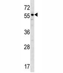BMP3 antibody western blot analysis in ZR-75-1 lysate. Predicted molecular weight: 55 kDa.