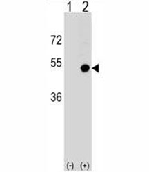 Western blot analysis of CD1d antibody and 293 cell lysate (2 ug/lane) either nontransfected (Lane 1) or transiently transfected (2) with the CD1D gene.