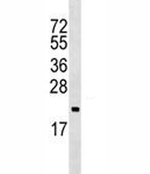 ARF5 antibody western blot analysis in Ramos lysate