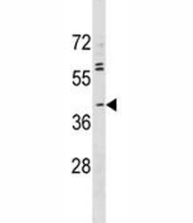 ABO antibody western blot analysis in MDA-MB231 lysate