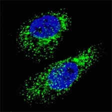 Fluorescent image of Chloroquine treated U251 cells (50 uM, 16h) stained with LC3A antibody. Immunoreactivity is localized to autophagic vacuoles in the cytoplasm of U251 cells.