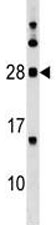 MOG antibody western blot analysis in human K562 lysate. Expected molecular weight: 15-28 kDa depending on glycosylation level.