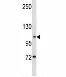 DOG1 antibody western blot analysis in human K562 lysate. Expected molecular weight 74-114 kDa but may be observed at higher molecular weights due to glycosylation.