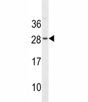 EPO antibody western blot analysis in WiDr lysate. Predicted molecular weight: 18-34 kDa depending on glycosylation level.
