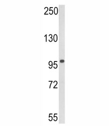 Western blot analysis of DDX58 in human 293 lysate. Expected molecular weight: 106-115 kDa.