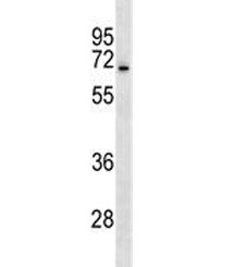 ASIC3 antibody western blot analysis in human CEM lysate. Predicted molecular weight ~59 kDa.