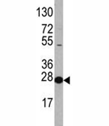 Western blot analysis of EIF4E antibody and HL-60 lysate. Predicted molecular weight ~27 kDa.