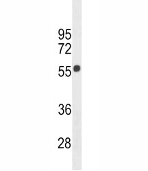 Cannabinoid Receptor 1 antibody western blot analysis in 293 lysate. Predicted molecular weight ~54 kDa.
