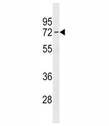 Estrogen Receptor antibody western blot analysis in 293 lysate. Predicted molecular weight: 65-70 kDa.