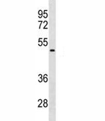 NEU1 antibody western blot analysis in HepG2 lysate. Predicted molecular weight ~45 kDa.