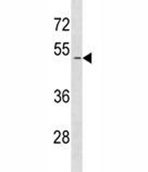 SMAD1 antibody western blot analysis in HeLa lysate. Predicted molecular weight: 52~60 kDa.