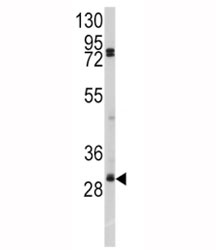 Western blot analysis of SLUG antibody and A2058 lysate. Predicted molecular weight ~ 30 kDa.