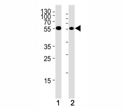 Chk1 antibody western blot analysis in (1) HeLa cell line and (2) mouse thymus tissue lysate. Predicted molecular weight ~54kDa.