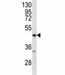 RAGE antibody western blot analysis in MDA-MB231 lysate. Predicted molecular weight: 45-55kDa depending on glycosylation level.